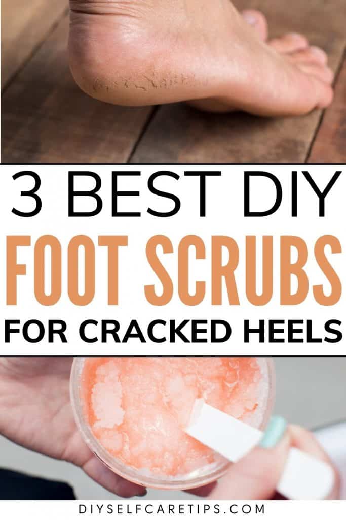 Best DIY foot scrubs for cracked heels. Do you struggle with cracked and rough heels? These 3 diy foot scrubs with natural ingredients are perfect to treat cracked heels at home. Click for recipe.