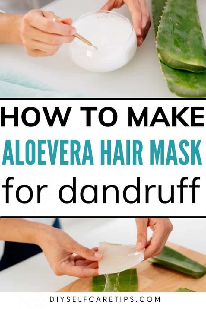 DIY Aloe Vera Hair Mask For Dandruff Recipe